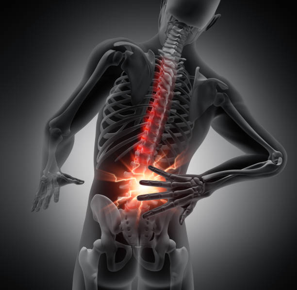 Low back fracture injuries Atlanta Injury Law Blog